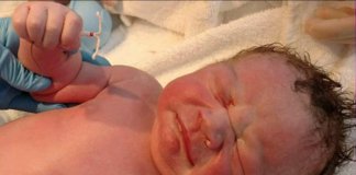 Bebê “nasce” segurando DIU e a sua foto viraliza na web