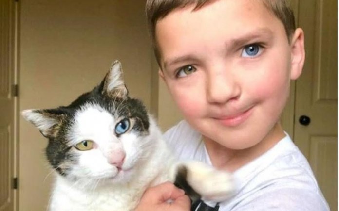 Garoto sofre bullying por sua aparência e adota gato com a mesma condição