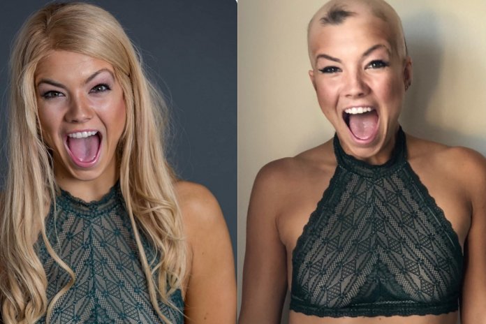 “careca e linda”: Dançarina com alopecia deixa peruca de vez e inspira outras mulheres