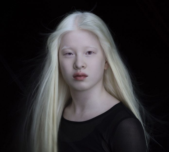 Bebê abandonada por ser albina cresce e se torna modelo da Vogue
