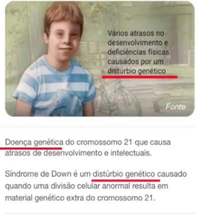 bemmaismulher.com - Jovem conseguiu que o Google mudasse a definição de síndrome de Down: "É uma condição, não uma doença"