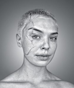 bemmaismulher.com - A modelo Giulia Dias diz que “Minha cicatriz não me define”