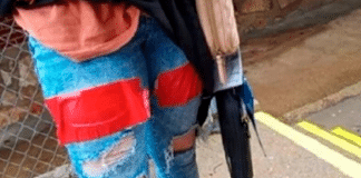 Mãe desaprova escola que cobriu rasgos de calça de sua filha com fita adesiva